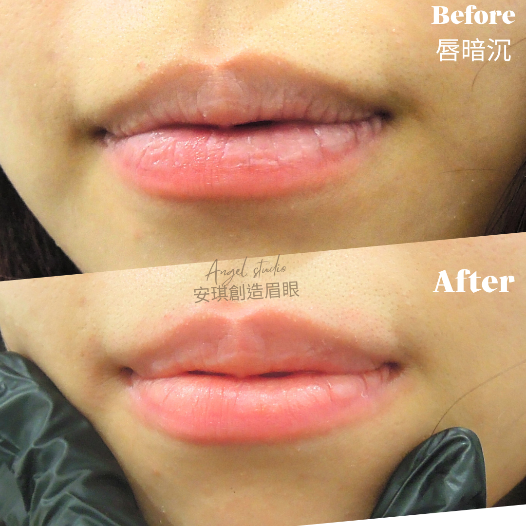 【唇色淡化還原】不是上色 而是把暗沉拿掉｜Before / After 真實分享