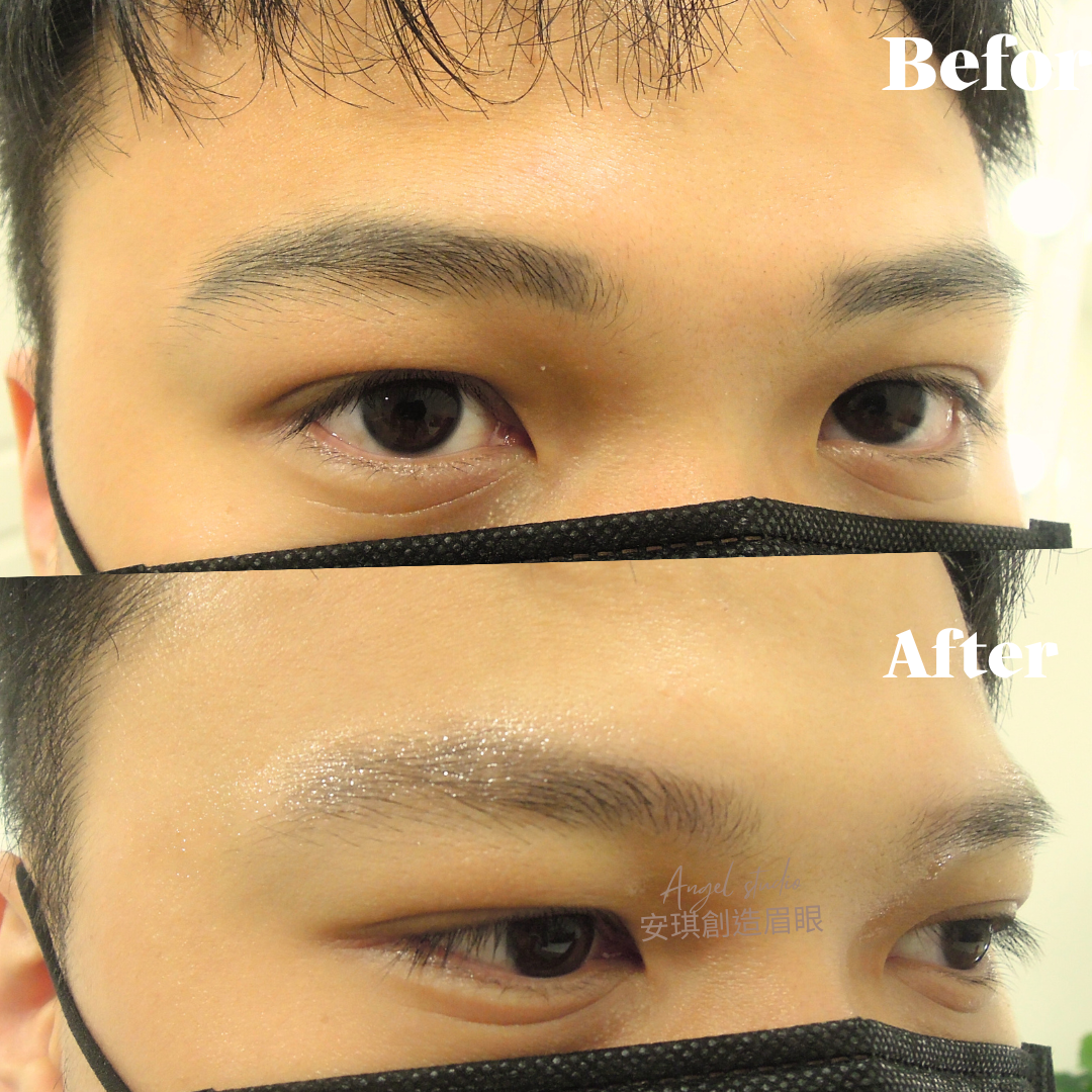 男士無創除色｜紋眉多年，一次無創洗眉 淡化真的有感